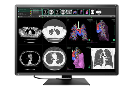 RX1270